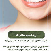 پیش‌نویس خودکار فرق بلیچینگ و دیگر روش ها در سفیدی دندان چیست؟                                                     20240817 142431 0000 180x180