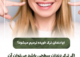 [object object] مراقبت های پس از درمان ریشه                                                     20240818 125456 0000 260x185  مطالب دندانپزشکی  D8 A7 D9 87 D9 85 DB 8C D8 AA  DA 86 DA A9 D8 A7 D9 BE  D8 AF D9 86 D8 AF D8 A7 D9 86  D9 87 D8 A7  D8 AF D8 B1  DA 86 DB 8C D8 B3 D8 AA D8 9F 20240818 125456 0000 260x185