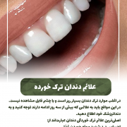 جویدن غذا به آرامی=سلامت دندان ها                                                     20240819 125519 0000 180x180