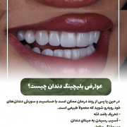 پیش‌نویس خودکار فرق بلیچینگ و دیگر روش ها در سفیدی دندان چیست؟                                                     20240821 124735 0000 180x180