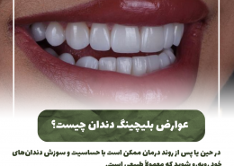 [object object] مراقبت های پس از درمان ریشه                                                     20240821 124735 0000 260x185  مطالب دندانپزشکی  D8 A7 D9 87 D9 85 DB 8C D8 AA  DA 86 DA A9 D8 A7 D9 BE  D8 AF D9 86 D8 AF D8 A7 D9 86  D9 87 D8 A7  D8 AF D8 B1  DA 86 DB 8C D8 B3 D8 AA D8 9F 20240821 124735 0000 260x185
