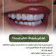 پیش‌نویس خودکار کش ارتودنسی                                                     20240821 124735 0000 80x80