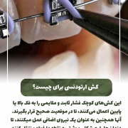 پیش‌نویس خودکار فرق بلیچینگ و دیگر روش ها در سفیدی دندان چیست؟                                                     20240822 120153 0000 180x180