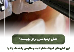 [object object] مراقبت های پس از درمان ریشه                                                     20240822 120153 0000 260x185  مطالب دندانپزشکی  D8 A7 D9 87 D9 85 DB 8C D8 AA  DA 86 DA A9 D8 A7 D9 BE  D8 AF D9 86 D8 AF D8 A7 D9 86  D9 87 D8 A7  D8 AF D8 B1  DA 86 DB 8C D8 B3 D8 AA D8 9F 20240822 120153 0000 260x185