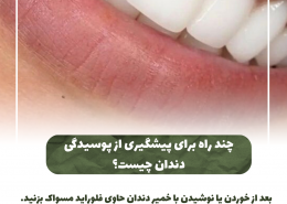 [object object] مراقبت های پس از درمان ریشه                                                     20240826 141056 0000 260x185  مطالب دندانپزشکی  D8 A7 D9 87 D9 85 DB 8C D8 AA  DA 86 DA A9 D8 A7 D9 BE  D8 AF D9 86 D8 AF D8 A7 D9 86  D9 87 D8 A7  D8 AF D8 B1  DA 86 DB 8C D8 B3 D8 AA D8 9F 20240826 141056 0000 260x185