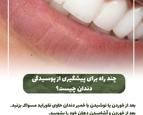 ترمیم و زیبایی دندانپزشکی ترمیمی و زیبایی                                                     20240826 141056 0000 495x400