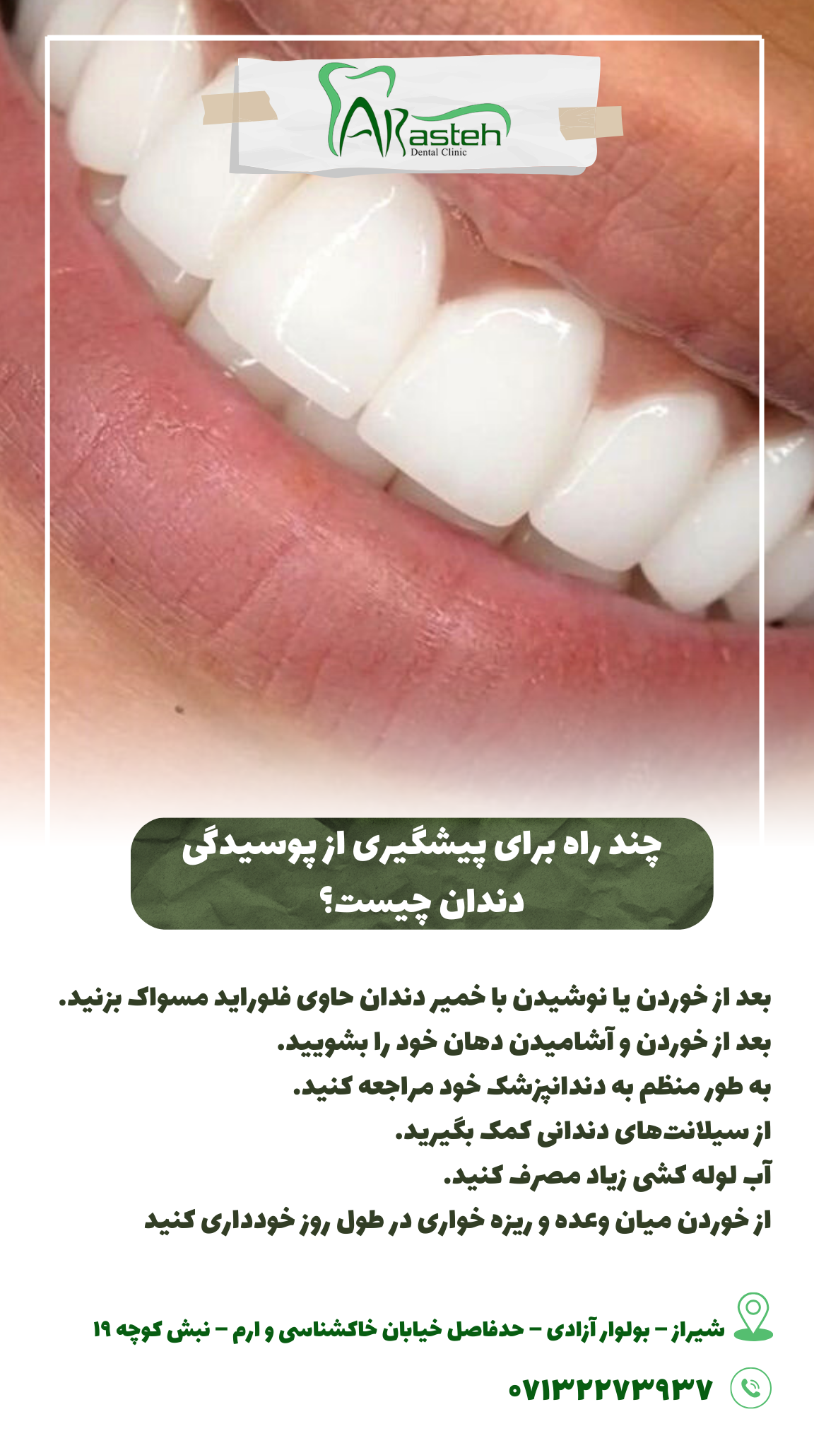 پیش‌نویس خودکار راهکاری برای پوسیده نشدن دندان ها                                                     20240826 141056 0000