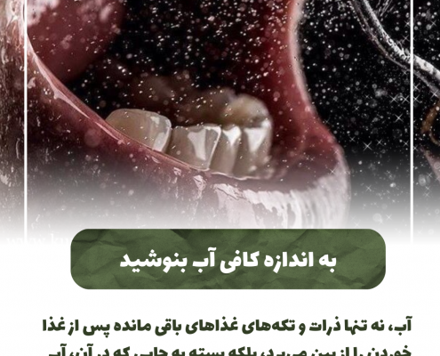 پیش‌نویس خودکار علایم عفونت پالپ دندان 1 20240717 131109 0000 495x400