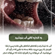 پیش‌نویس خودکار دهان شویه 1 20240717 131109 0000 80x80