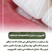 پیش‌نویس خودکار فرق بلیچینگ و دیگر روش ها در سفیدی دندان چیست؟ 1 20240723 155251 0000 180x180