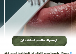 [object object] مراقبت های پس از درمان ریشه IMG 20250319 133310 869 260x185  مطالب دندانپزشکی IMG 20250319 133310 869 260x185