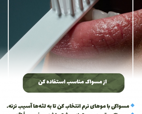 پیش‌نویس خودکار از مسواک مناسب استفاده کنید IMG 20250319 133310 869 495x400