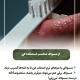 پیش‌نویس خودکار علائم عفونت پالپ دندان به صورت زیر است: IMG 20250319 133310 869 80x80
