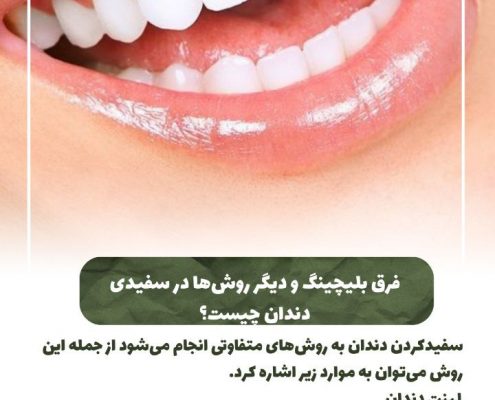 پیش‌نویس خودکار از مسواک مناسب استفاده کنید IMG 20250319 133311 563 495x400