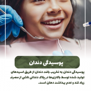 پیش‌نویس خودکار پوسیدگی دندان IMG 20250319 133319 330 180x180
