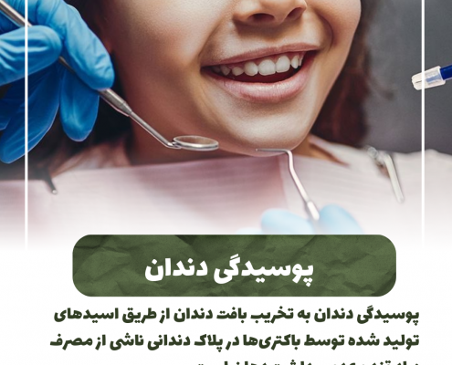 پیش‌نویس خودکار از مسواک مناسب استفاده کنید IMG 20250319 133319 330 495x400