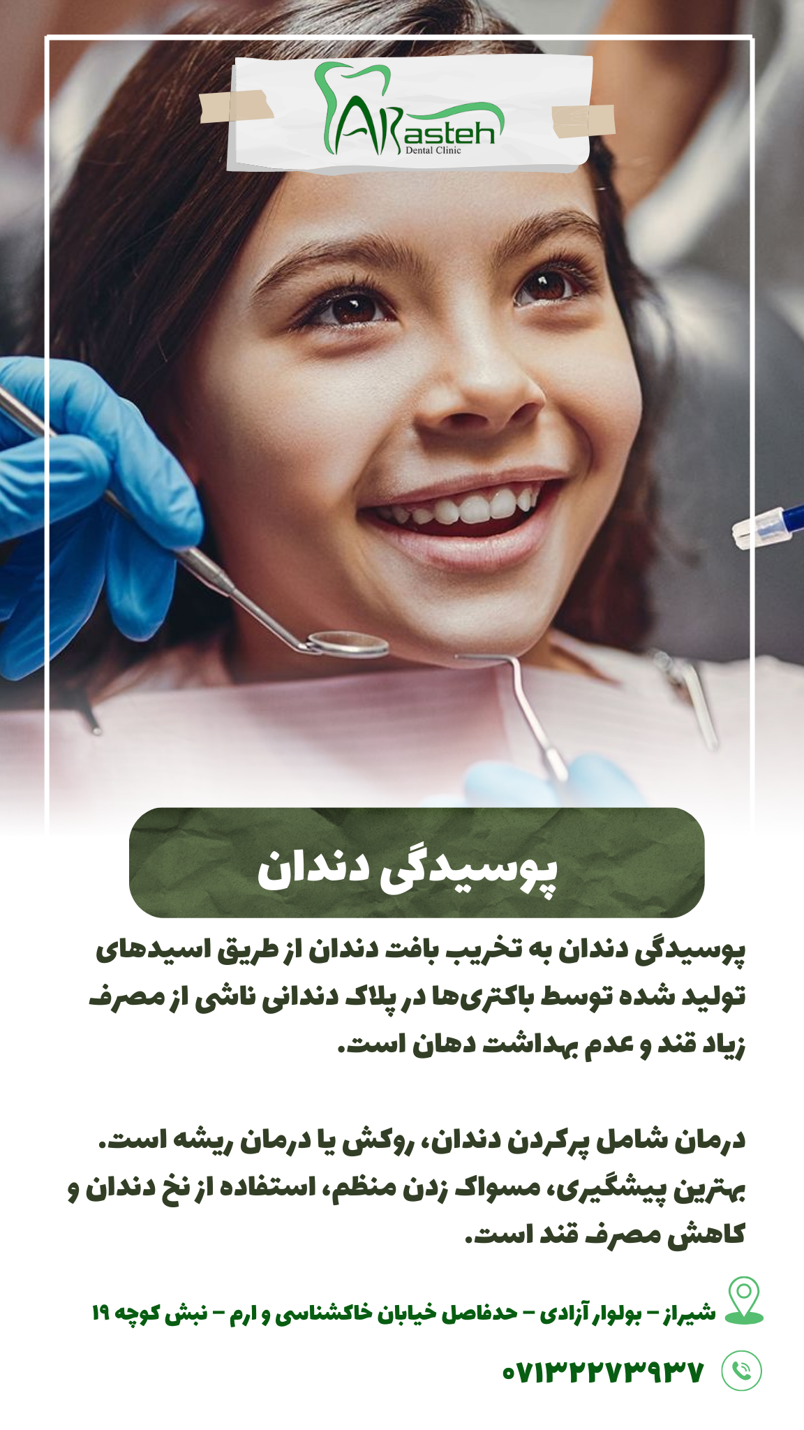 پیش‌نویس خودکار پوسیدگی دندان IMG 20250319 133319 330