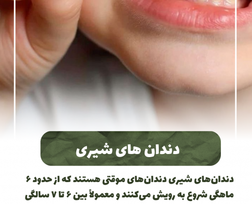پیش‌نویس خودکار مسواک زدن در کودکان:شروع و اهمیت IMG 20250319 133319 445 495x400