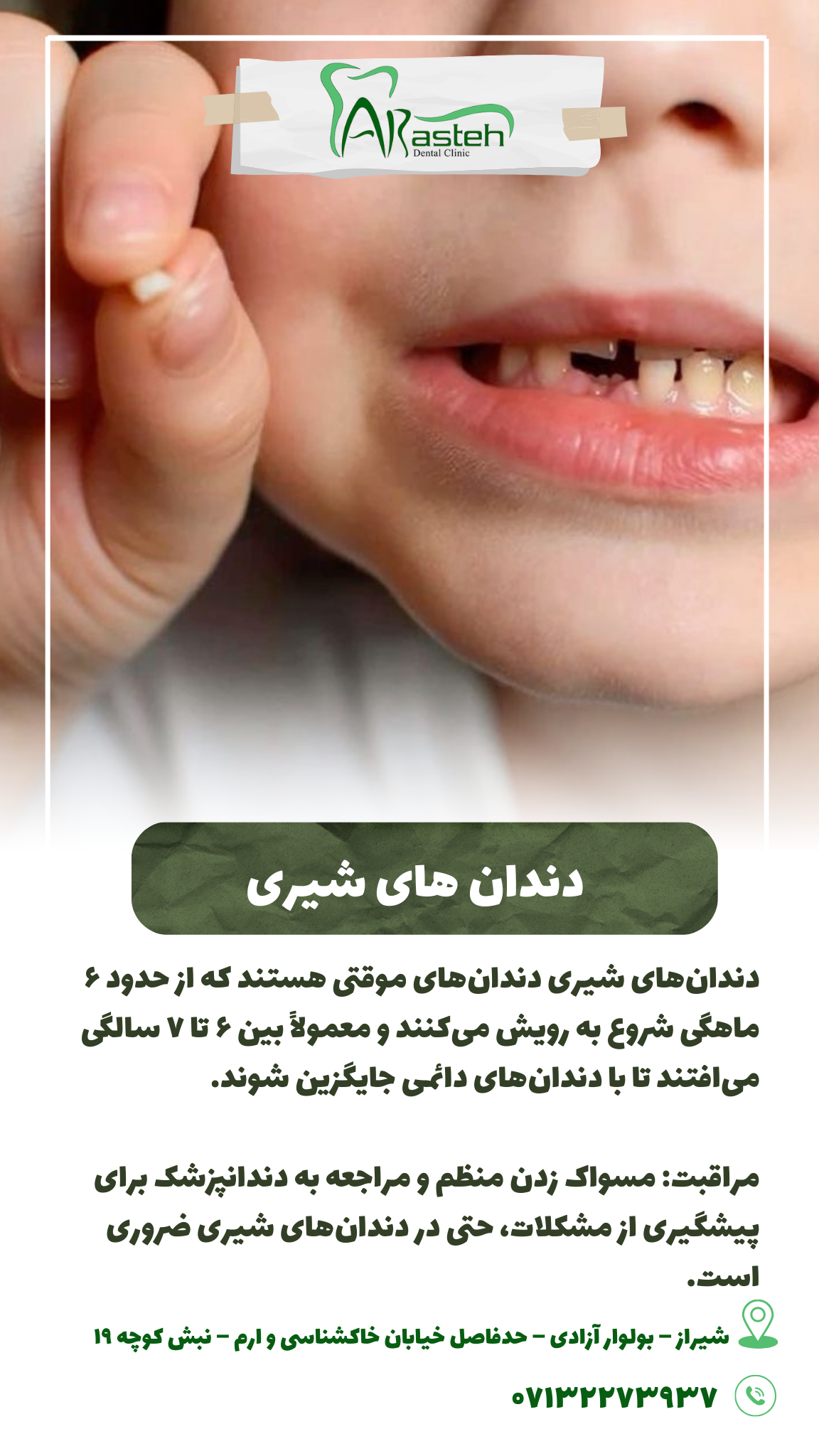 پیش‌نویس خودکار دندان های شیری IMG 20250319 133319 445