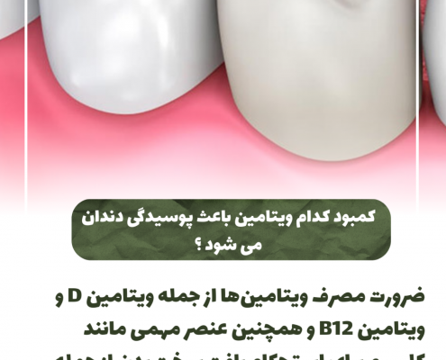 پیش‌نویس خودکار از مسواک مناسب استفاده کنید IMG 20250319 133325 751 495x400