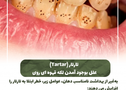 [object object] مراقبت های پس از درمان ریشه IMG 20250319 133326 144 260x185  مطالب دندانپزشکی IMG 20250319 133326 144 260x185