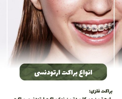 پیش‌نویس خودکار کامپوزیت دندان IMG 20250319 133326 289 495x400