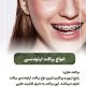 پیش‌نویس خودکار مسواک زدن در کودکان:شروع و اهمیت IMG 20250319 133326 289 80x80