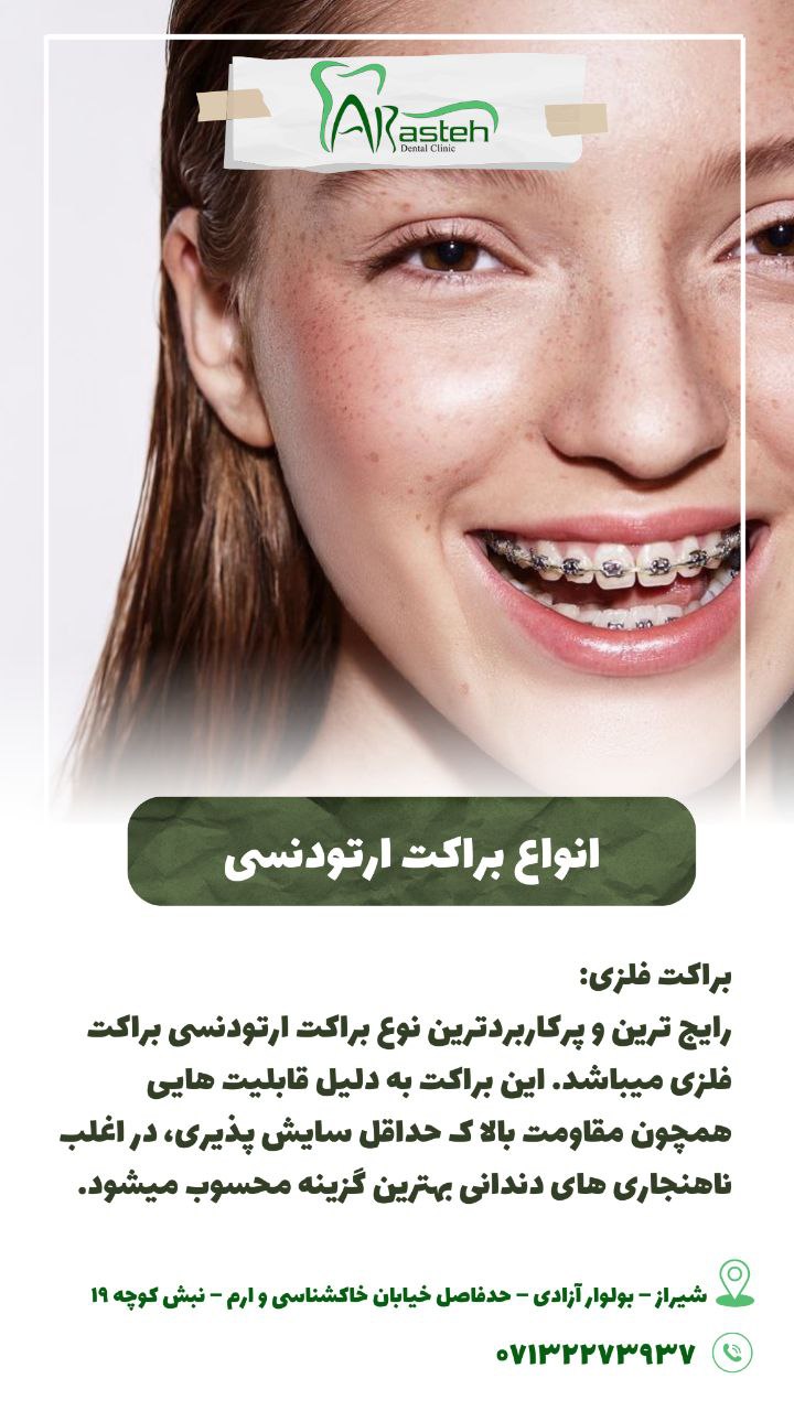 پیش‌نویس خودکار انواع براکت ارتودنسی IMG 20250319 133326 289