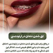پیش‌نویس خودکار پوسیدگی دندان IMG 20250319 133326 309 180x180