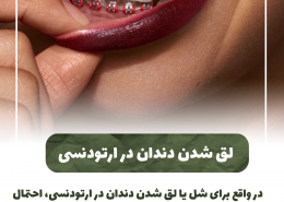 [object object] مراقبت های پس از درمان ریشه IMG 20250319 133326 309 260x185  مطالب دندانپزشکی IMG 20250319 133326 309 260x185