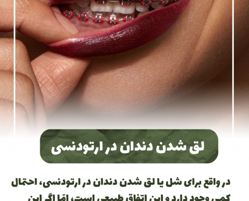 پیش‌نویس خودکار مسواک زدن در کودکان:شروع و اهمیت IMG 20250319 133326 309 495x400