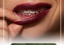 [object object] مراقبت های پس از درمان ریشه IMG 20250319 133326 309 e1765735621504 260x185  مطالب دندانپزشکی IMG 20250319 133326 309 e1765735621504 260x185