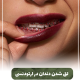 لکه ی قهوه ای روی دندان IMG 20250319 133326 309 e1765735621504 80x80