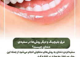 [object object] مراقبت های پس از درمان ریشه                                                     20240703 152750 0000 260x185  مطالب دندانپزشکی  D8 A7 D9 87 D9 85 DB 8C D8 AA  DA 86 DA A9 D8 A7 D9 BE  D8 AF D9 86 D8 AF D8 A7 D9 86  D9 87 D8 A7  D8 AF D8 B1  DA 86 DB 8C D8 B3 D8 AA D8 9F 20240703 152750 0000 260x185